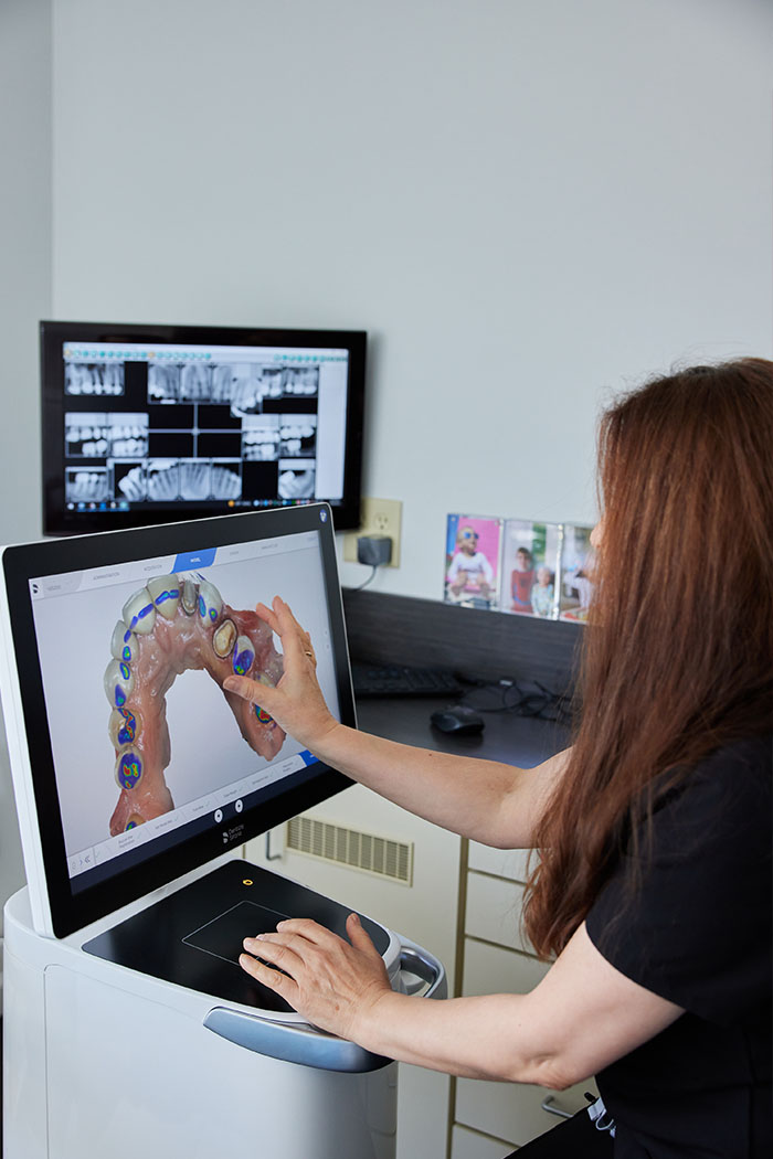 Woman using a dental scanner, focusing on a 3D model of a mouth displayed on a monitor.